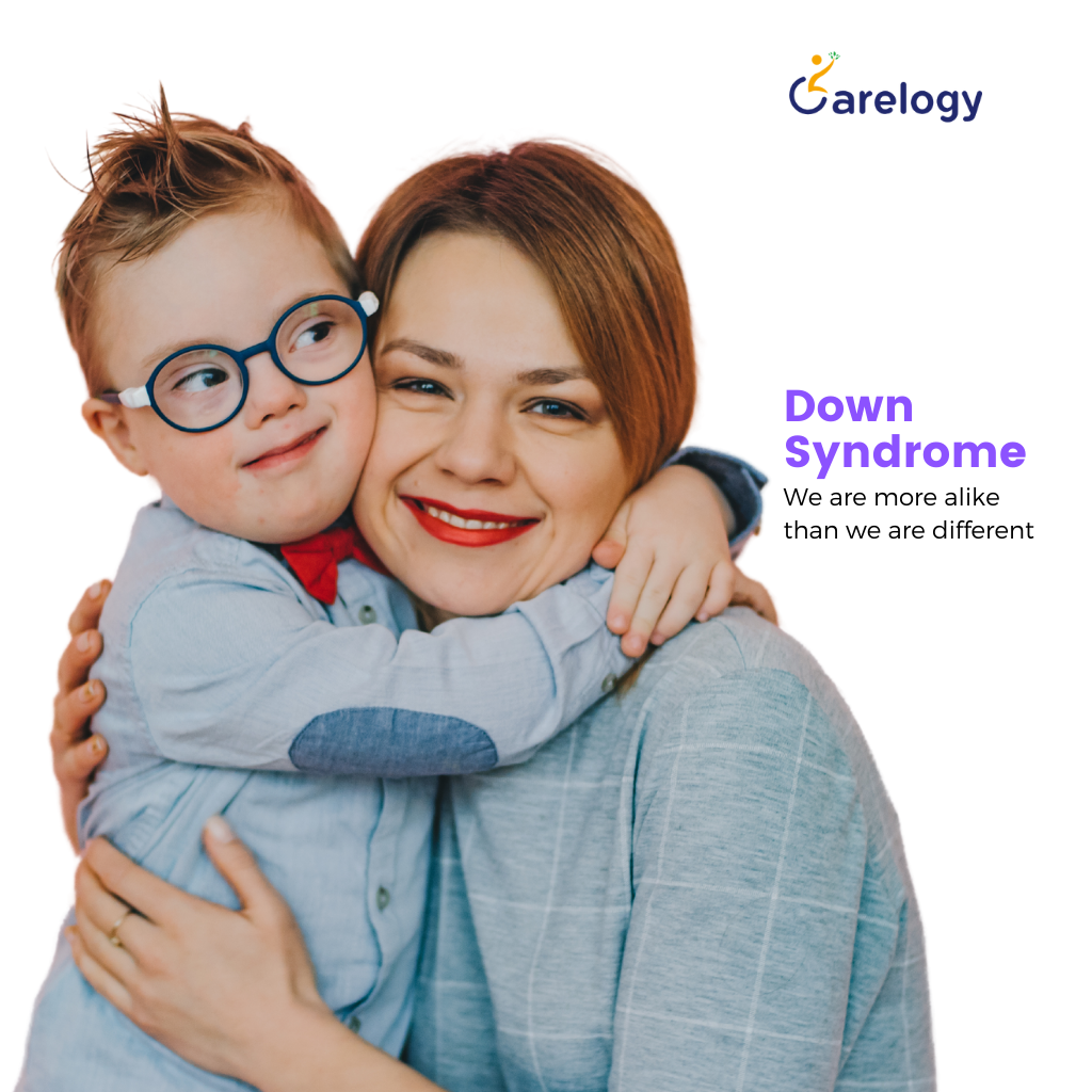 How Long Can a Down Syndrome Person Live? | Key Insights